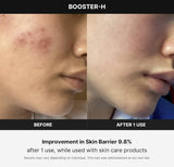 Medicube AGE-R Booster-H