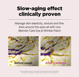 <RED> ISOI Blemish Care Eye & Wrinkle Patch 90g / 90pcs