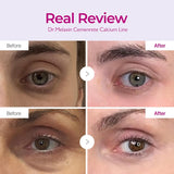 Dr.Melaxin Cemenrete Calcium Intense Cream 50ml / 1.69 fl. oz.