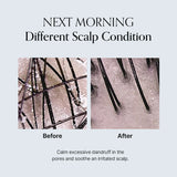 GROWUS Damage Therapy Scalp Scaling Ampoule 50ml / 1.69 fl. oz.