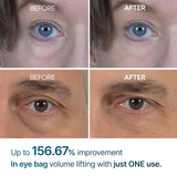 Dr.Melaxin Eyephalt Eyebag Cream 10ml