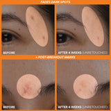 innisfree Green Tea Enzyme Vitamin C Brightening Serum 30ml / 1.01 fl. oz