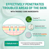 SOME BY MI Micro Pin Spot Patch Pack of 1, 14mm 9 Counts