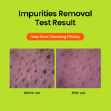 Beplain Mung Bean pH-Balanced Cleansing Foam 5.4fl.oz / 160ml