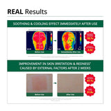 Dr.G Red Blemish Essence 80ml