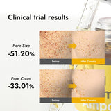 MIZON Snail Repair Intensive Ampoule 1.01 fl. oz / 30ml