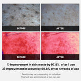 Medicube Red Succinic Acid Panthenol Facial Peeling Pads 70 Pads