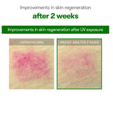 <RED> VT Cosmetics CICA Reedle Shot 700 1Fl Oz 30ml / 1.01 fl. oz.