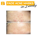 <RED> Numbuzin No.5+ Vitamin Concentrated Serum 2pk 30ml + 30ml  / 1.01 fl. oz.