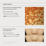 Some by MI Yuja Niacin Anti Blemish Cream 60ml / 2.02 oz