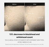 <RED> Medicube Zero Pore One-day Serum 30ml / 1.01 fl. oz.