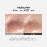 Sungboon Editor Blackhead Melting Clear Pad 30