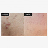 <RED> VT Reedle CICA Reedle Shot 100 Essence 50ml / 1.69 fl. oz.