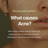 Pyunkang Yul Calming Acne Cleansing Foam 3.38 Fl. Oz, 100ml