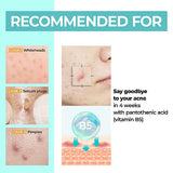 <viral> Numbuzin No.1 Pantothenic B5 Active Soothing Cream 2pk  80ml +80ml