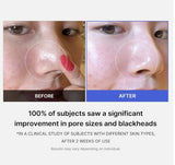 <RED> Medicube Zero Pore Pad 2.0